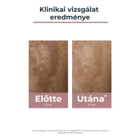 Eucerin Anti-Pigment éjszakai arckrém