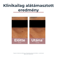Eucerin Anti-Pigment szemránckrém