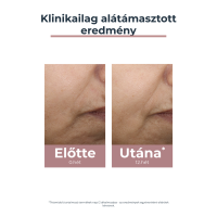 Eucerin Anti-Pigment színezett nappali arckrém medium SPF30