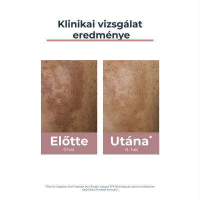 Eucerin Anti-Pigment Nappali arckrém SPF30
