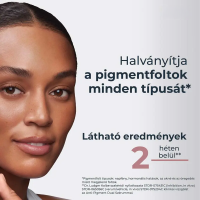 Eucerin Anti-Pigment bőrtökéletesítő szérum