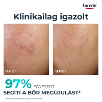 Eucerin DermoPure Clinical Peeling 10 - bőrmegújító szérum