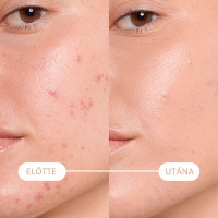 Bioderma Sébium Kerato+ cover krém