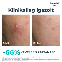 Eucerin DermoPure Clinical Triple Action - korrektív fluid