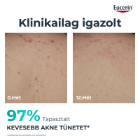Eucerin DermoPure Clinical Correcting Body Care - testkrém