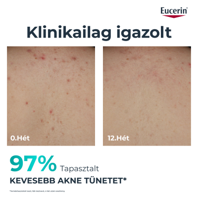 Eucerin DermoPure Clinical Correcting Body Care - testkrém