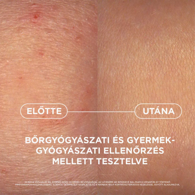 Bioderma Ad atoderm intensive balzsam, 75ML kiszerelés
