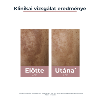 Eucerin Anti-Pigment Dual Szérum